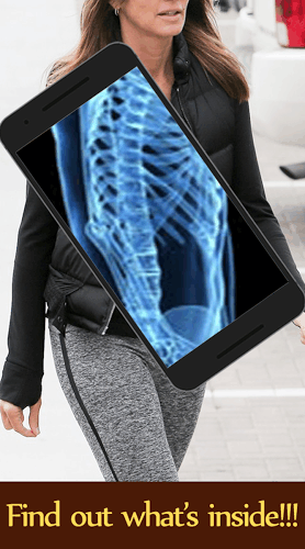 Full Body Xray Scanner Prank截图5