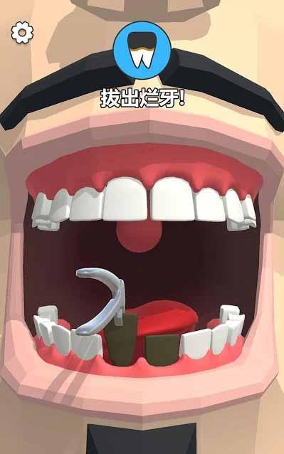 洗牙 Mod截图4