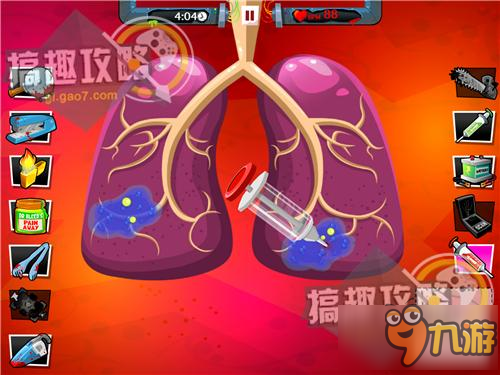 疯狂外科医生4攻略 Amateur Surgeon 4五星通关攻略