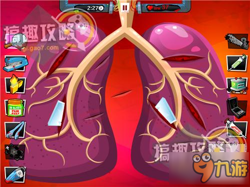 瘋狂外科醫(yī)生4攻略 Amateur Surgeon 4五星通關攻略