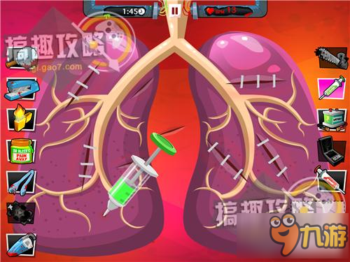 疯狂外科医生4攻略 Amateur Surgeon 4五星通关攻略