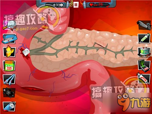 瘋狂外科醫(yī)生4第8關(guān)五星攻略 Amateur Surgeon4攻略8