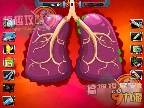 瘋狂外科醫(yī)生4第12關(guān)五星攻略 Amateur Surgeon4攻略12