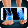 Xray Fracture Foot Prank怎么下载