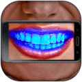 Teeth Germ Scanner Simulator Appiphone版下载