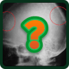 Radiologic signs免费下载